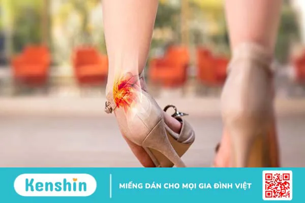 Mắt cá chân có tác dụng gì? Vấn đề thường gặp ở mắt cá chân