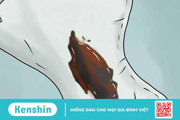 Máu kinh màu nâu có bình thường không? Nên làm gì khi máu kinh màu nâu?  1