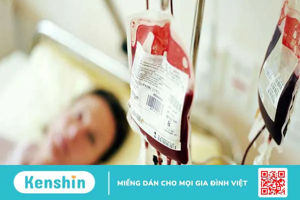 Máu toàn phần là gì? Cách bảo quản và sử dụng 3