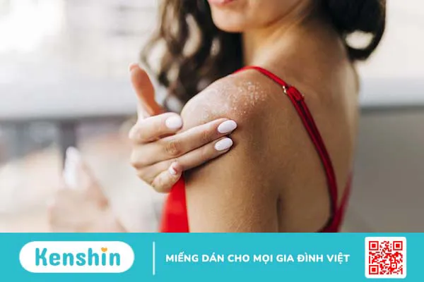 Máu xấu ở phụ nữ có nguy hiểm không? Dấu hiệu và cách lọc sạch máu 2