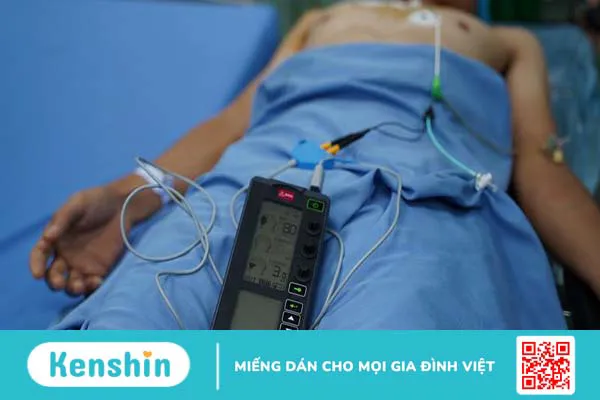 Máy tạo nhịp tim tạm thời – Giải pháp hỗ trợ nhịp tim ổn định