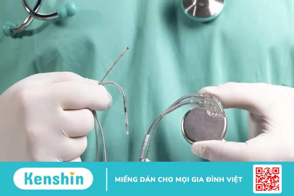 Máy tạo nhịp tim vĩnh viễn: Theo dõi nhịp tim tự động