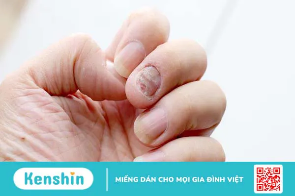 Mẹ bầu làm nail có ảnh hưởng đến thai nhi không?