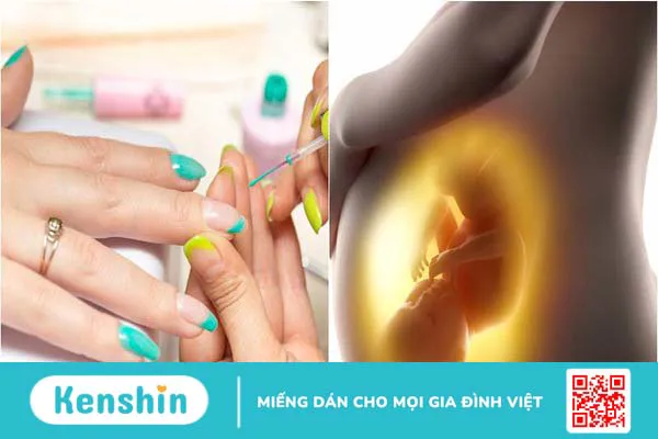 Mẹ bầu làm nail có ảnh hưởng đến thai nhi không?