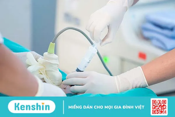 Mẹ bầu nên khám sàng lọc trước sinh ở tuần bao nhiêu là đúng?