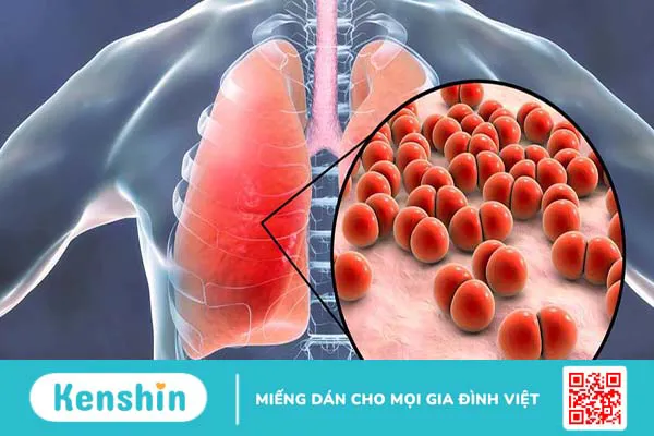 Mệt mỏi khó thở là biểu hiện của bệnh gì? Xử lý như thế nào khi mệt mỏi khó thở?