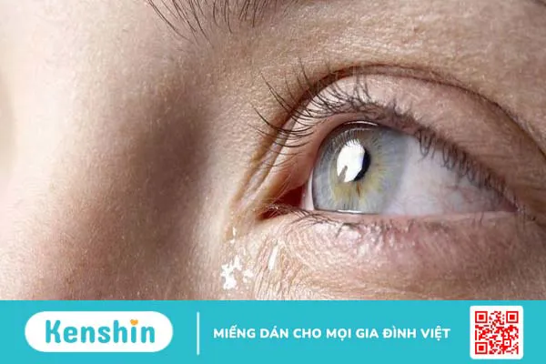 Mí mắt trên bị sưng đỏ và đau: Nguyên nhân và cách khắc phục
