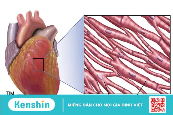 Mô cơ tim là gì? Các bệnh thường gặp ở mô cơ tim