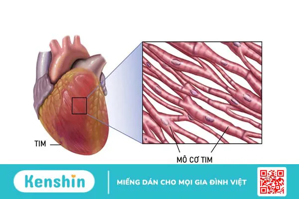 Mô cơ tim là gì? Các bệnh thường gặp ở mô cơ tim