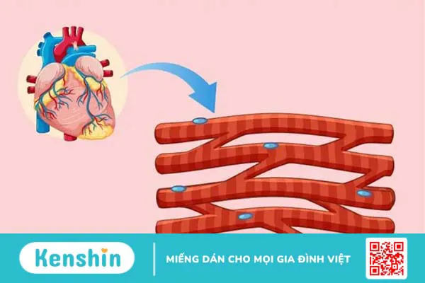 Mô cơ tim là gì? Các bệnh thường gặp ở mô cơ tim