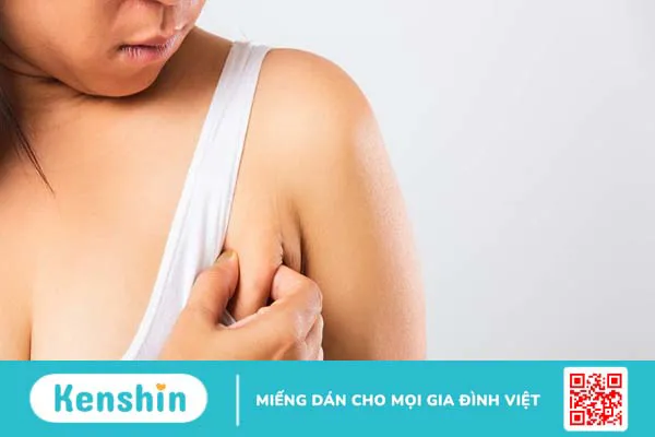 Mỡ nách bẩm sinh có giảm được không?