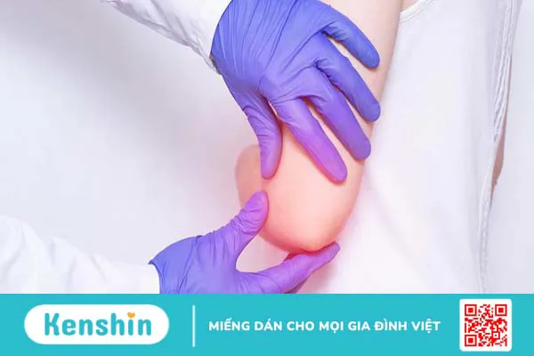 Một số bệnh lý liên quan đến khuỷu tay thường gặp