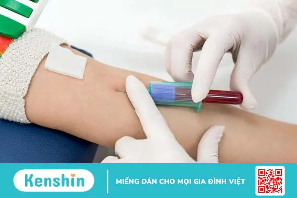 Một số thông tin về khí máu động mạch và khí máu tĩnh mạch