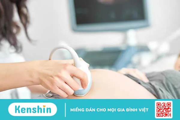 Nang đám rối mạch mạc: Nguyên nhân và cách điều trị