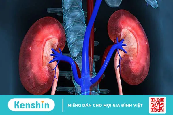 Nang thận bẩm sinh có nguy hiểm không? Cách chữa trị thế nào?