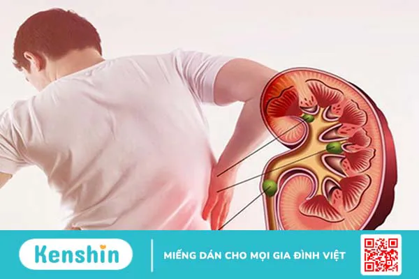 Nang thận bẩm sinh có nguy hiểm không? Cách chữa trị thế nào1