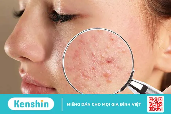 Nên đắp mặt nạ đất sét trước hay mặt nạ giấy trước?