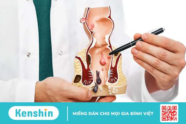 Nên khám trĩ ở đâu Hà Nội để đảm bảo chính xác?