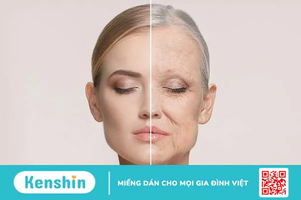 Nếp nhăn là gì? Nguyên nhân hình thành và dấu hiệu nhận biết 2