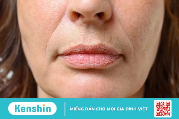 Nếp nhăn là gì? Nguyên nhân hình thành và dấu hiệu nhận biết 4