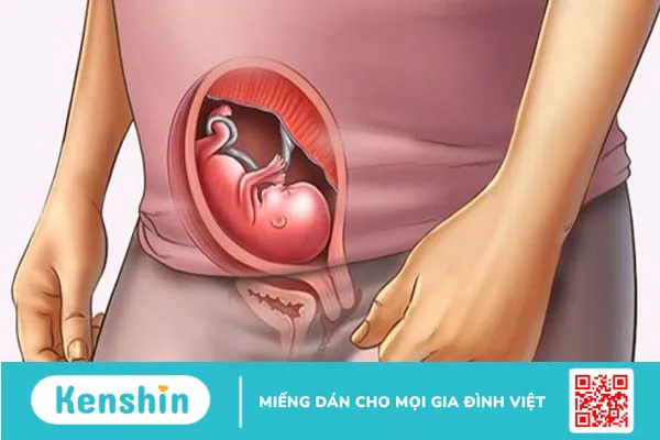 Ngôi thai thuận tuần 32 có dấu hiệu gì? Những lưu ý cần biết với mẹ bầu 32 tuần