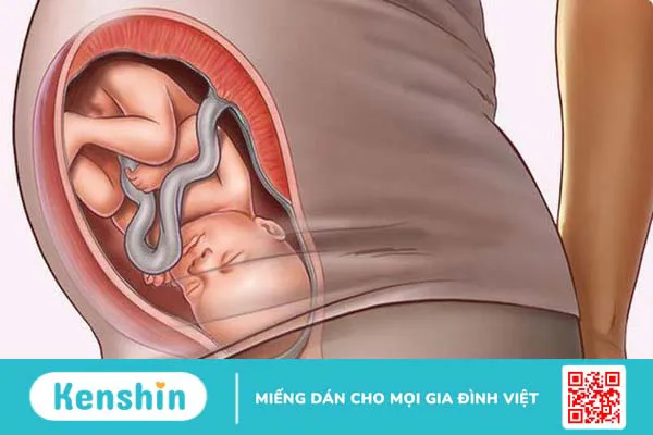 Ngôi thai thuận tuần 32 có dấu hiệu gì? Những lưu ý cần biết với mẹ bầu 32 tuần