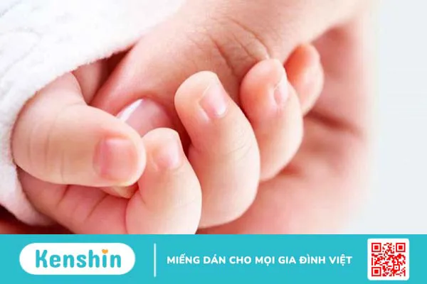 Ngón tay bị cong bẩm sinh: Nguyên nhân, triệu chứng và cách điều trị hiệu quả 3