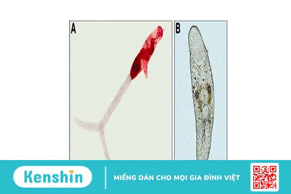 Ngứa da sau khi đi bơi liệu có sao không?