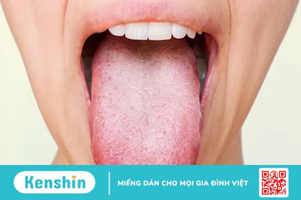 Ngứa lưỡi: Triệu chứng nói lên sức khỏe không ổn định của bạn