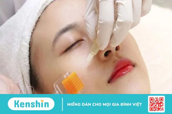 Người có làn da mỏng yếu có lăn kim được không?