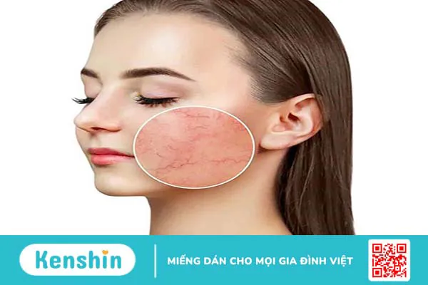 Người có làn da mỏng yếu có lăn kim được không?