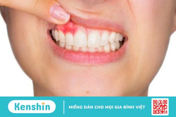 Nguy cơ đối mặt với nhiều bệnh lý từ việc thiếu vi chất