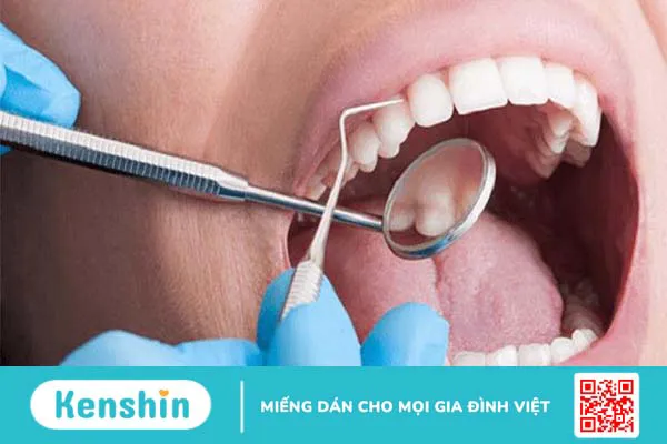 Nguyên nhân gây đau nhức răng cửa và cách khắc phục