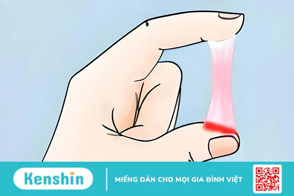 Nguyên nhân gây hiện tượng khí hư có 1 ít sợi máu có thể bạn chưa biết