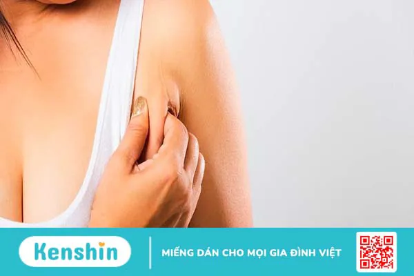 Nguyên nhân gây mỡ nách nhiều và cách khắc phục hiệu quả