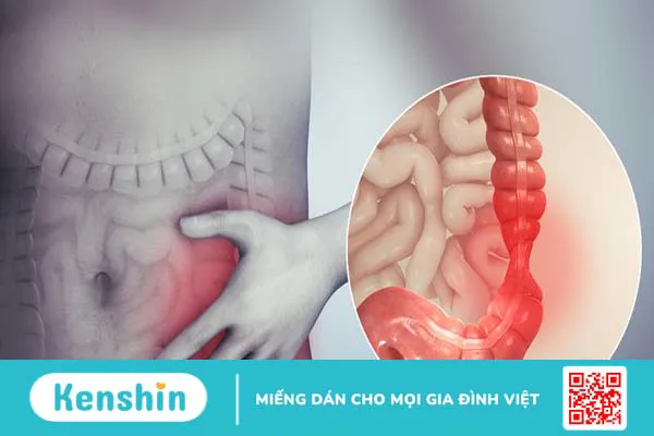 Nguyên nhân gây ra tình trạng đau bụng tiêu chảy