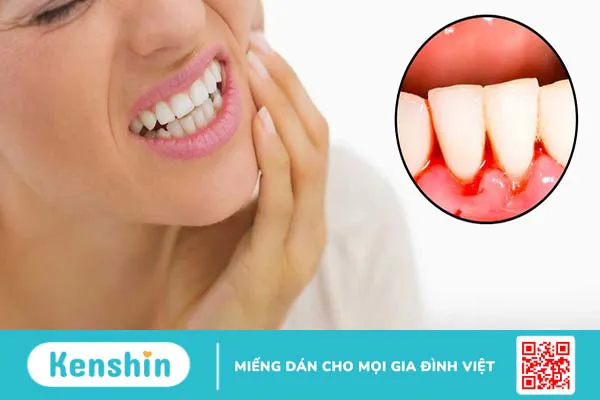 chân răng bị sưng 1