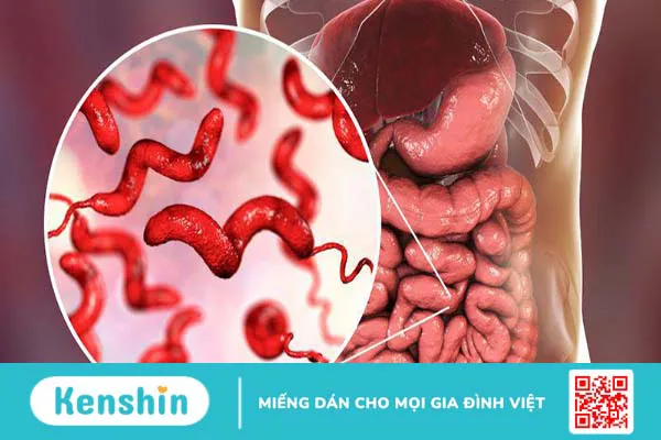 Nguyên nhân nhiễm vi khuẩn campylobacter và cách phòng ngừa 1