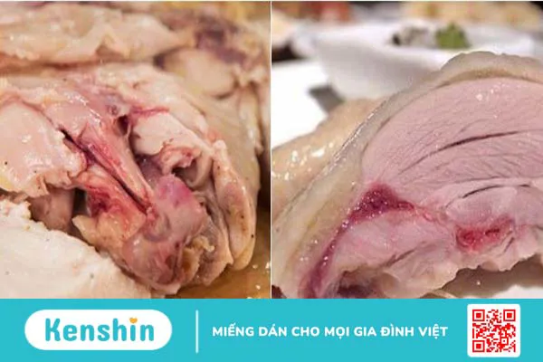 Nguyên nhân nhiễm vi khuẩn campylobacter và cách phòng ngừa 3