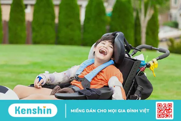 Bại não thể phối hợp: Nguyên nhân, triệu chứng và cách điều trị 2