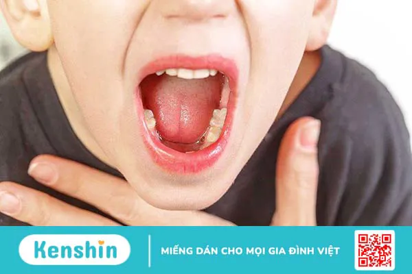Nguyên nhân và triệu chứng của bệnh viêm mũi họng cấp ở trẻ em