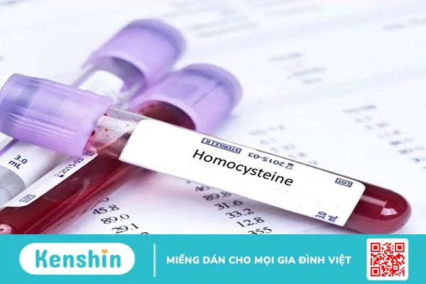 Nguyên nhân vì sao chỉ số Homocysteine cao làm tăng nguy cơ bệnh tim? 1