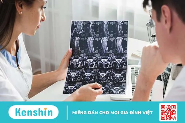 Nhận biết đau rễ dây thần kinh tọa theo từng vị trí