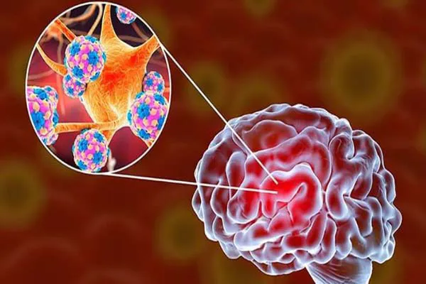 Nhiễm virus cytomegalo: Triệu chứng, biến chứng, điều trị và phòng ngừa 3