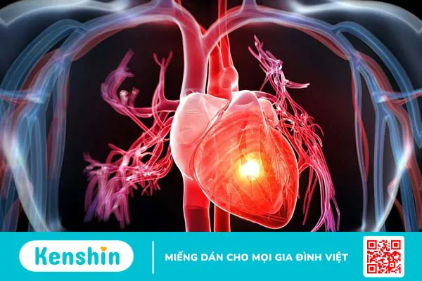 Nhịp chậm xoang: Nguyên nhân, triệu chứng và cách điều trị