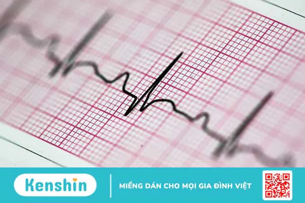 Nhịp xoang là gì? Triệu chứng và điều trị loạn nhịp xoang