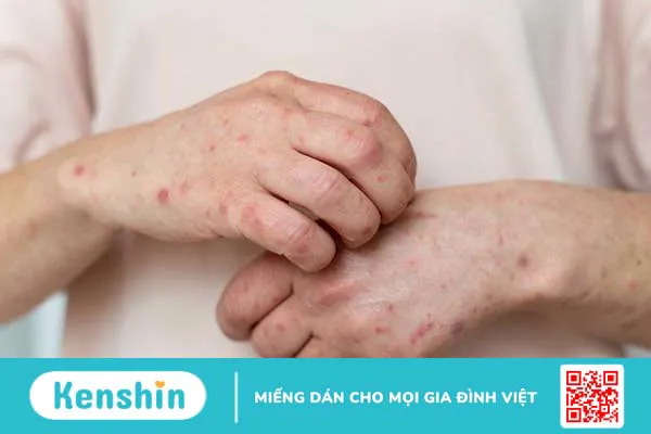 Nhóm các xoắn khuẩn gây bệnh