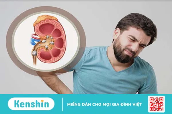 Những ai không nên ăn rau cải chíp?