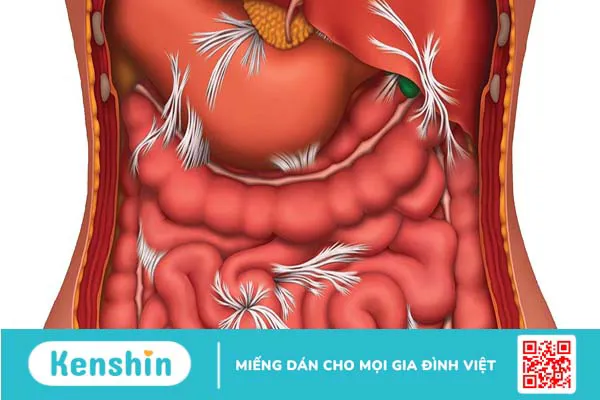 Những đặc điểm của giải phẫu mạch máu ổ bụng