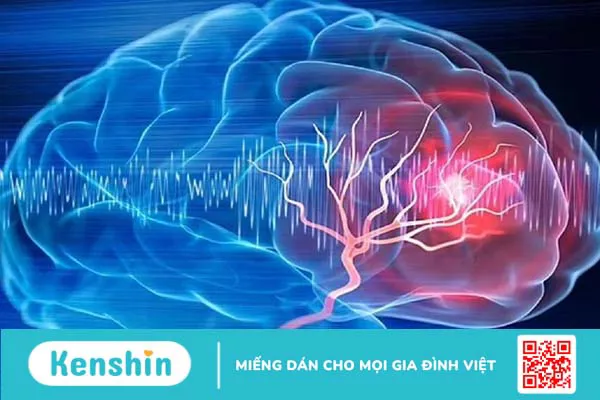 Những dấu hiệu não có vấn đề thường gặp